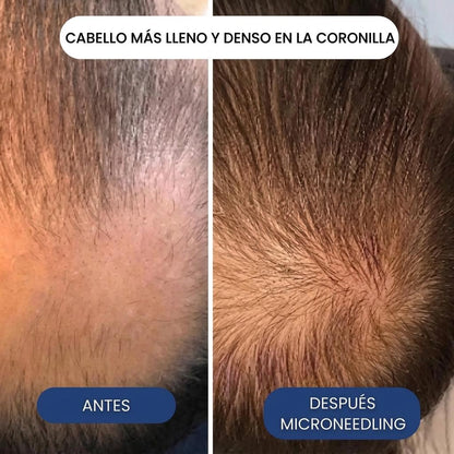 Pepcobrix Sistema para el Crecimiento del Cabello